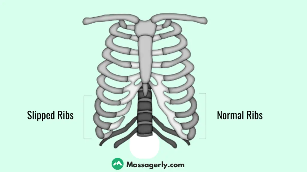 how to massage a rib back into place